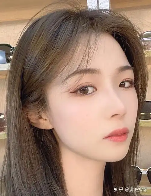 鼻整形直鼻or翘鼻or直鼻微翘3个核心要点