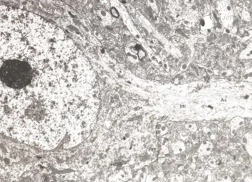 正文              胎儿脊髓前角运动神经元 : nu:nucleus细胞核  no