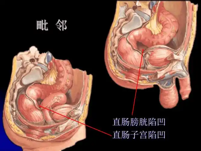 直肠肛管解剖ppt课件ppt