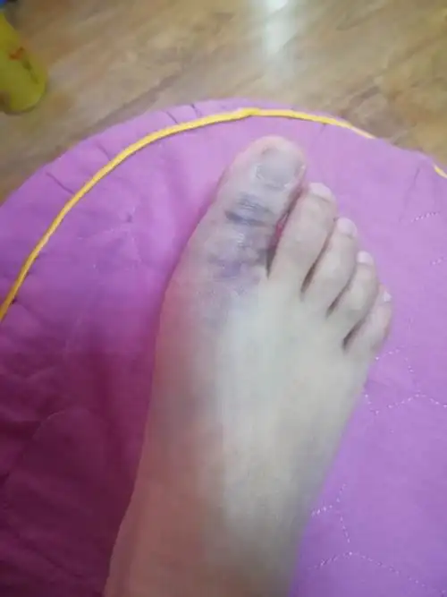 因天爱蹦床公园保护措施不到位摔伤,对方拒绝承担责任