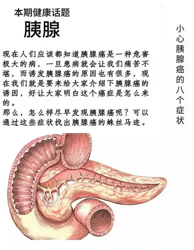 吉林省肿瘤医院专家提醒您 患上胰腺癌,最先出现的症状有哪些?