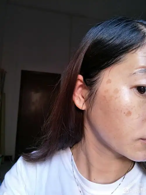 如何去斑点(如何去斑点小偏方)_大全-幸福起航