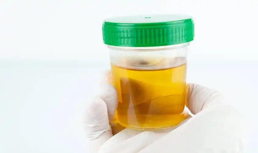 当肝脏或胆囊发生病变时,胆汁到肠道的路被切断,就只能经尿液排除了