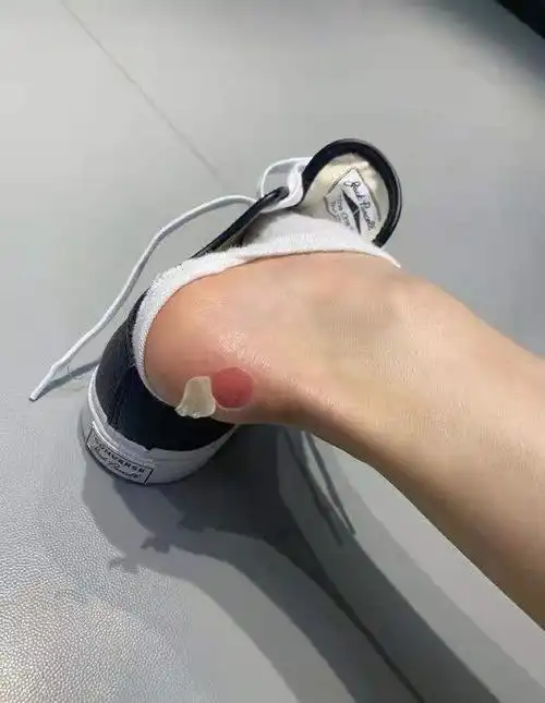 鞋子磨脚怎么办呢compeed防磨脚膏怎么样commpeed有用吗穿高跟鞋磨脚