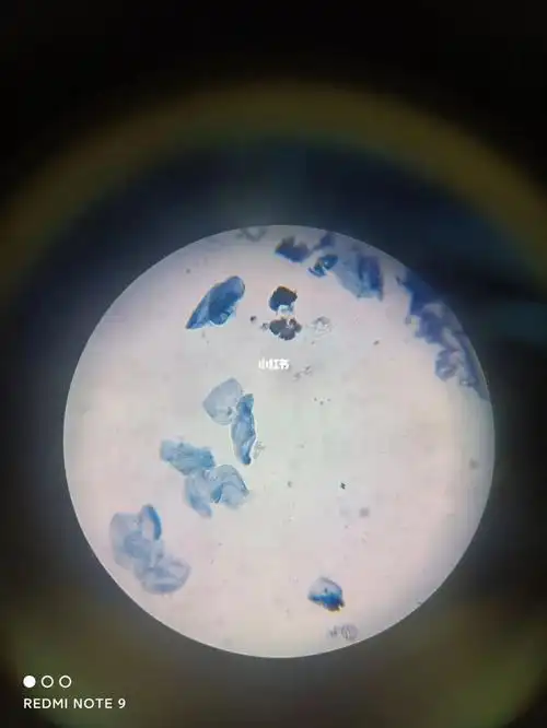 口腔上颚上皮细胞