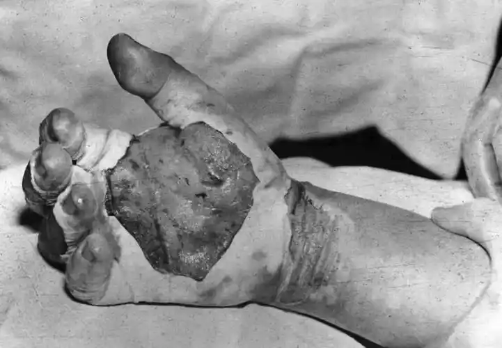 这也是第一次直接导致人员死亡的临界事故,美国因此重新制定了一份