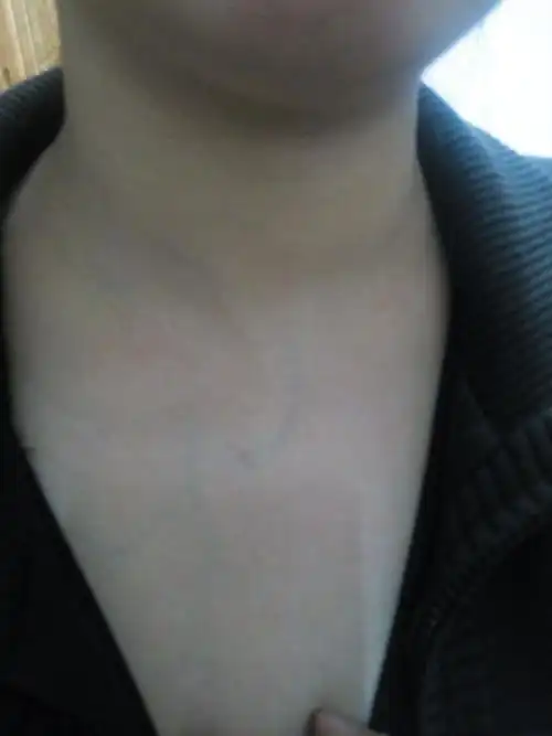 肚子没花,发现脖子上的黑线是啥