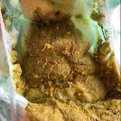 今天宝宝大便中带有像黑色细线一样的东西,很多一小条一小条的,知道是