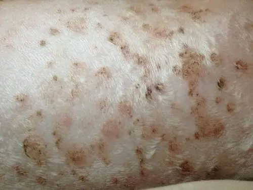 帮忙看下我家狗狗得得是什么皮肤病?