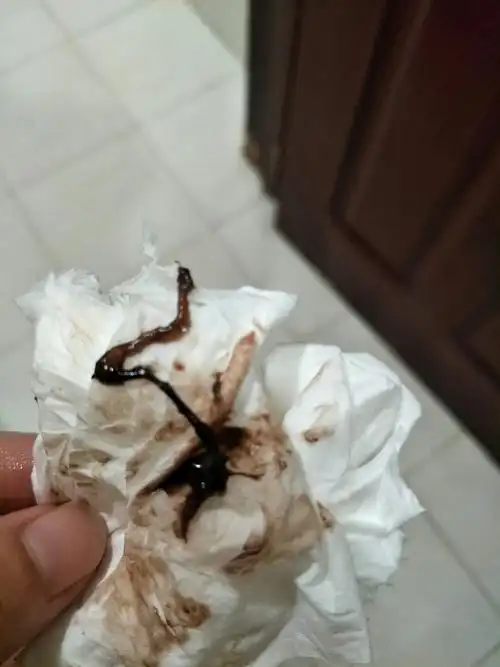 意见 第一次怀孕流产的可能性是比较小的只有平时的身体不是很好的人