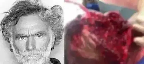 【毒品知识】至今为止见过最恐怖的毒品!