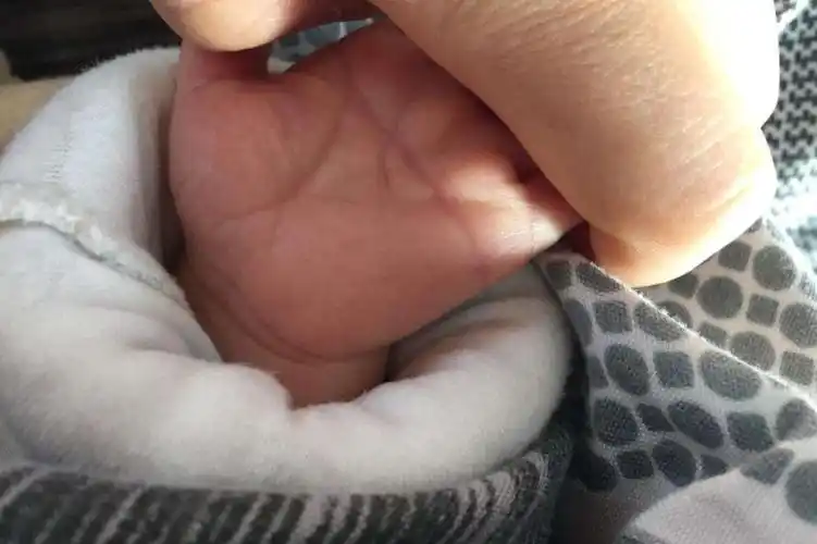 什么是唐氏综合症(导致唐氏综合症的原因)