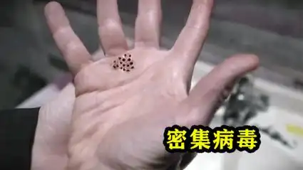 女人在卫生间感染上了恐怖密集病毒