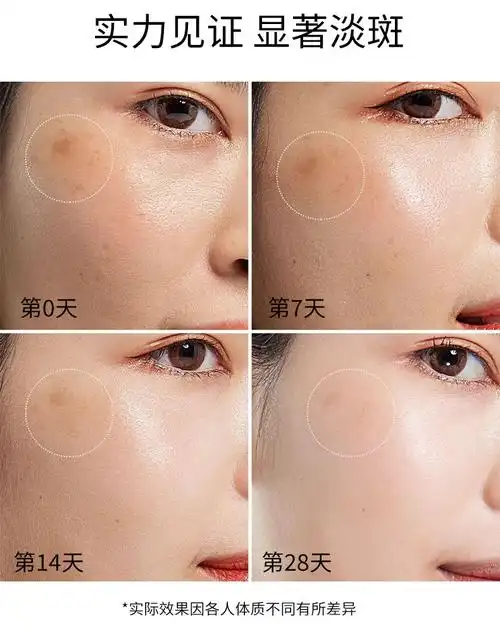 精华液露烟酰胺透明质酸钠改善肌肤黑色素雀斑黄褐斑晒斑男女通用4862