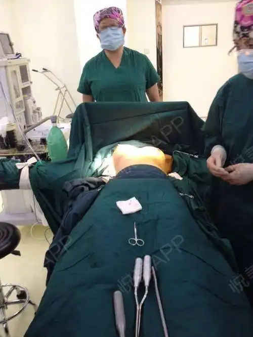 自体脂肪隆胸术后1天_形体填充术后1天_隆胸术后1天_自体脂肪术后1天