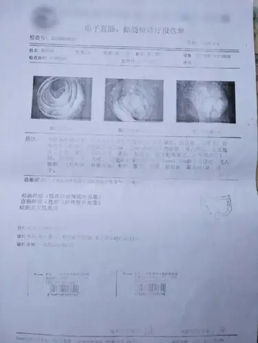 (肠镜检查报告)