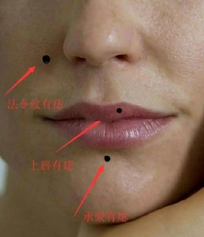 1,上唇有痣:擅长言辞,衣食无忧,但是要注意肠胃方面的问题.