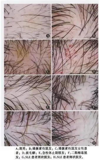 硬核科普| 毛囊检测到底是什么?有什么作用呢?