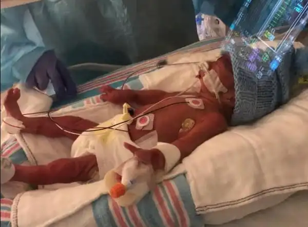 女子怀孕29周竟然丝毫不知 外出旅游飞机上早产一婴儿