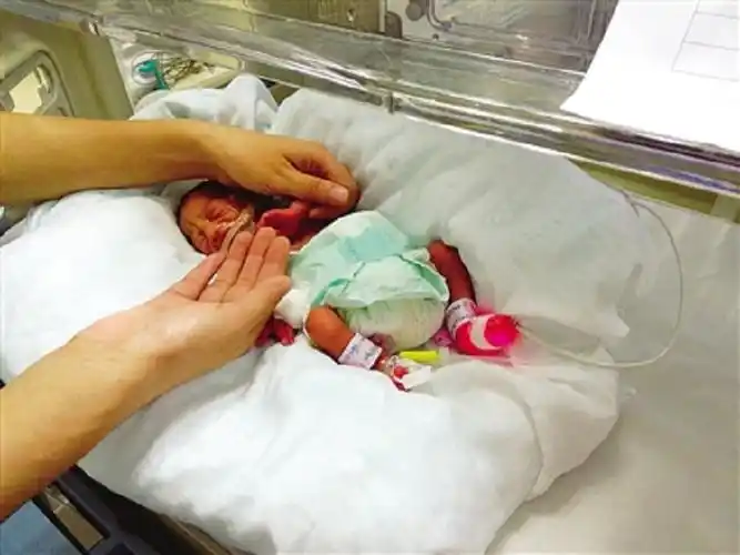 32周就出生的早产儿大脑发育会受到影响吗