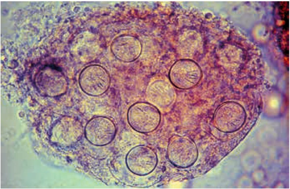 犬复孔绦虫综述