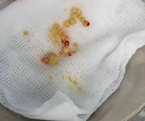 狗狗得了结石尿不出来,两万块钱能治好吗?(铲屎官自述)