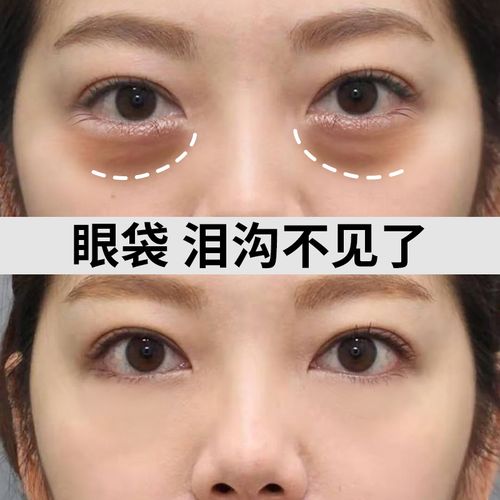 【李佳琪推荐】熬夜跟黑眼圈 泪沟说拜拜 眼部丰盈原液 收缩眼袋