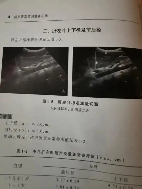 学习超声第10day