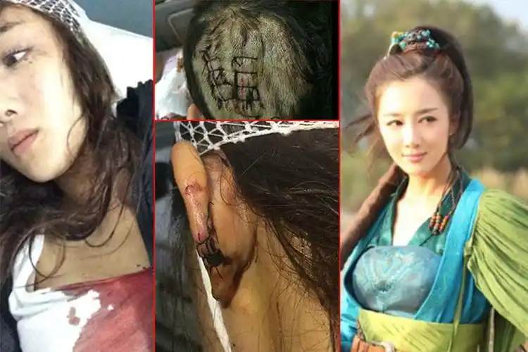 李依晓被咬事件李依晓军装本文共6026字