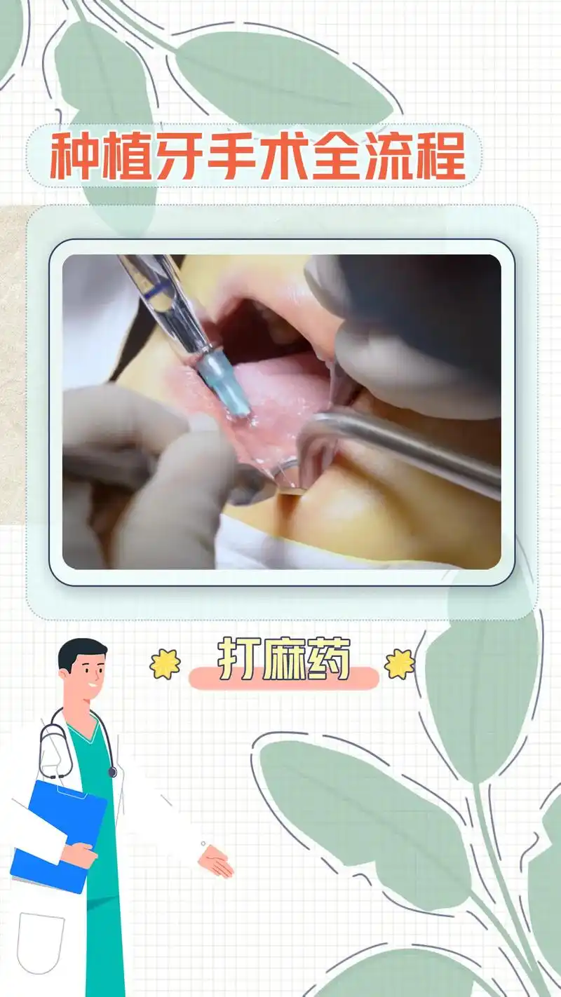 种植牙手术全流程#口腔健康 #种植牙 - 抖音
