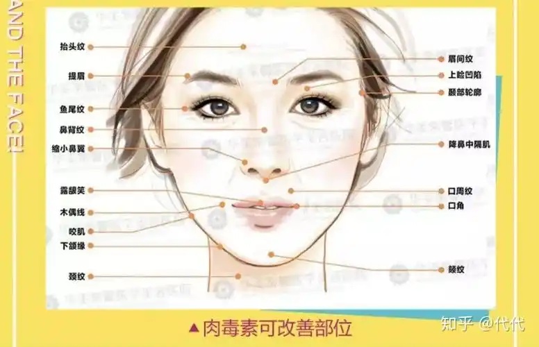 皱纹爬上脸了,先打肉毒素还是玻尿酸呢?