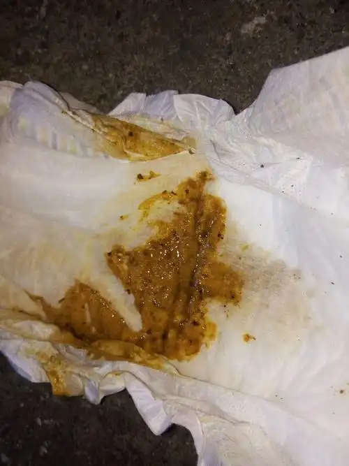 粑粑正常吗 是黄的 有点稀 是怎么回事