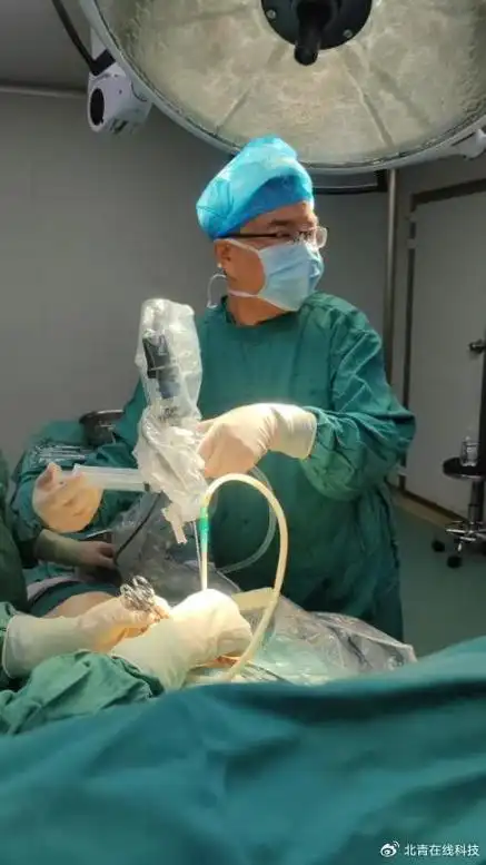 明好医院结石专家强强联合一次性为患者取出胆囊息肉消除泌尿结石