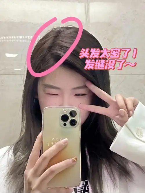 真实存在的发缝不好意思来炫发量了