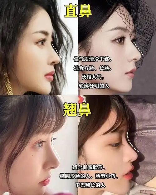 如何选择适合自己的鼻型71附模板75必看如何根据自己的_圈子-新氧
