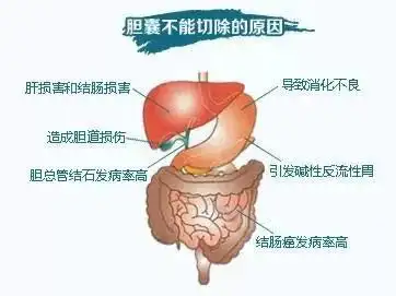 胆囊息肉和胆囊结石是一回事吗,哪个更严重?
