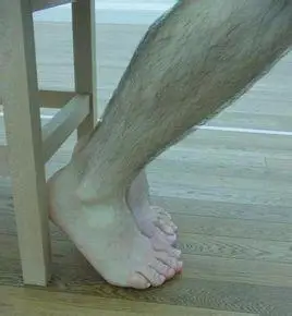 生长在人类的大腿与小腿,脚掌,脚趾上生长的毛发.