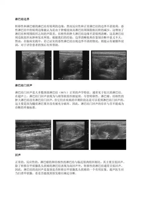 颈部淋巴结的超声诊断