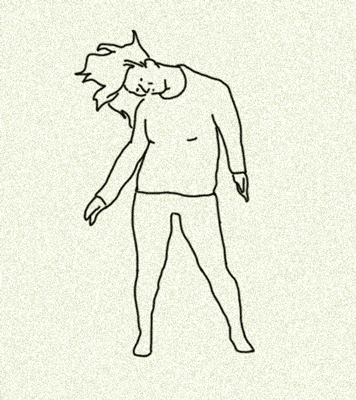 8岁女童跳甩头舞太卖力颈部关节半脱位