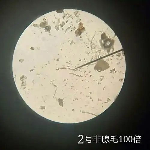 因为看到了非腺毛,所以判断为金银花