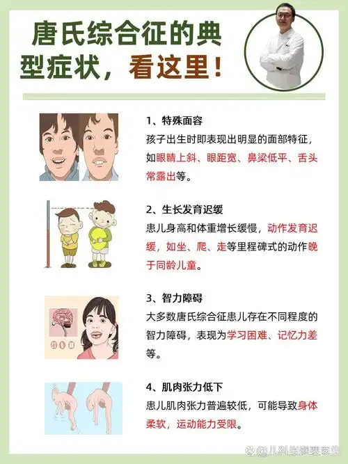 唐氏综合征症状主要