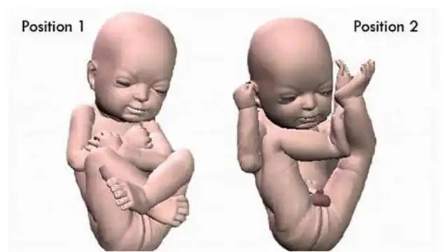 劲爆!孕妇怀男孩的特征"怀孕检测"-第2张图片-智库博客