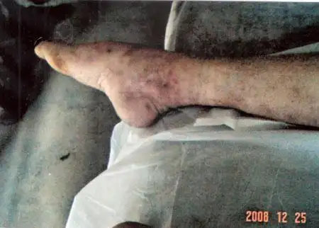 少年服刑期间死亡 家属称尸体青紫鼻流黄液(图)