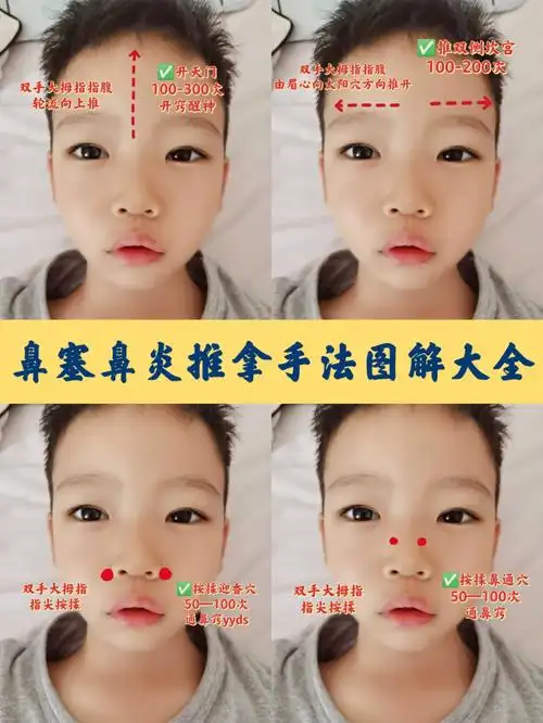 小儿鼻塞流涕推拿穴位图解谁按谁知道75