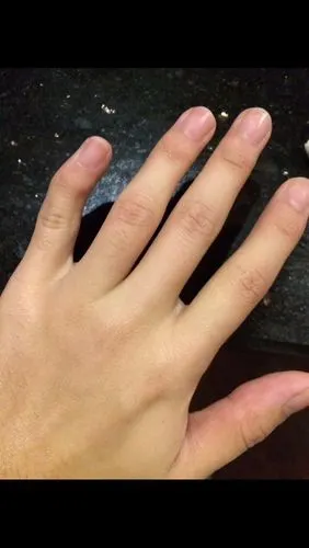 小拇指内弯适合弹吉他吗?