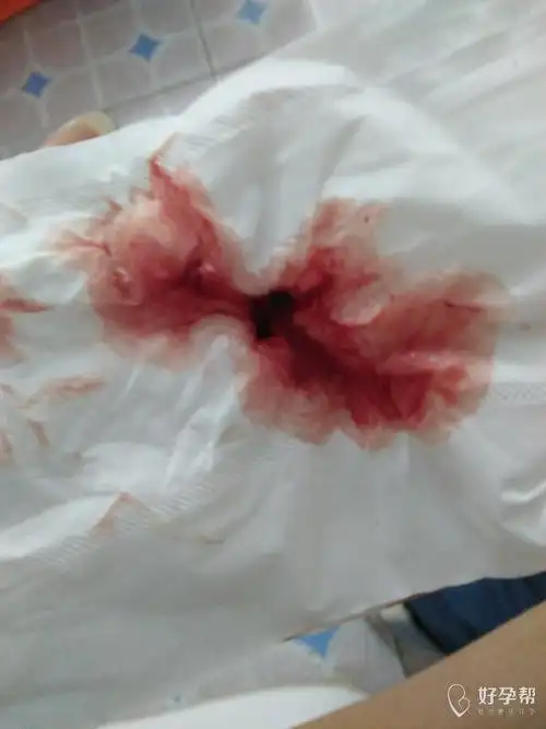 图片有点恶心!不喜别喷