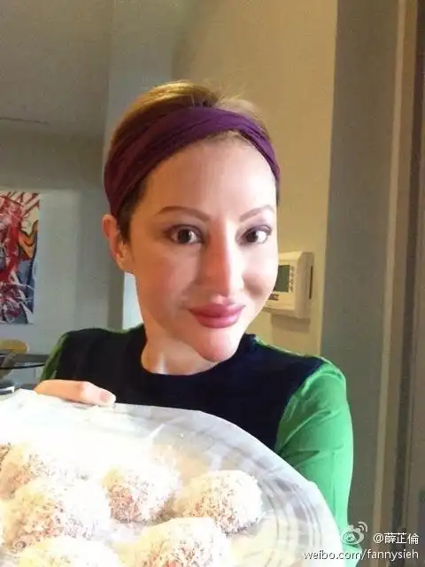 组图:港星薛芷伦整容失败超惊悚 曾演《倩女幽魂》小青