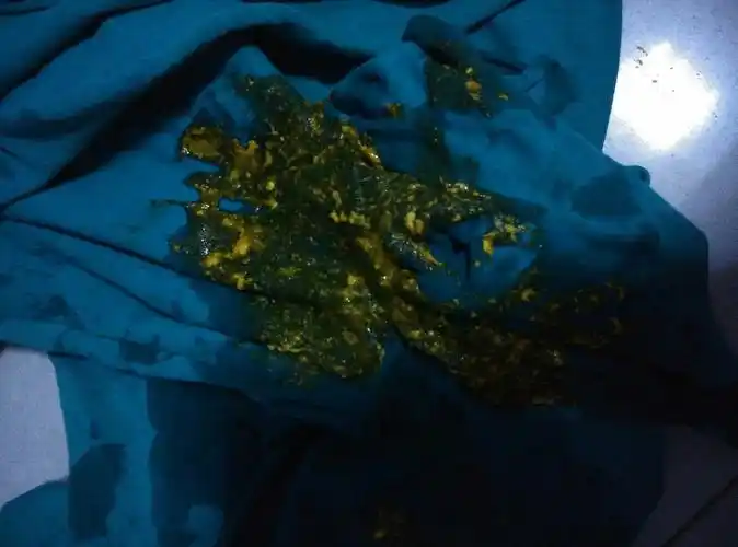 [母乳喂养]看我宝宝拉的臭臭有问题吗?