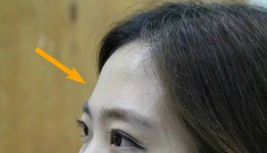 额头有个凹陷代表什么