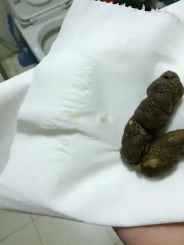 我家七个月泰迪拉出便便里有白色小虫子怎么办